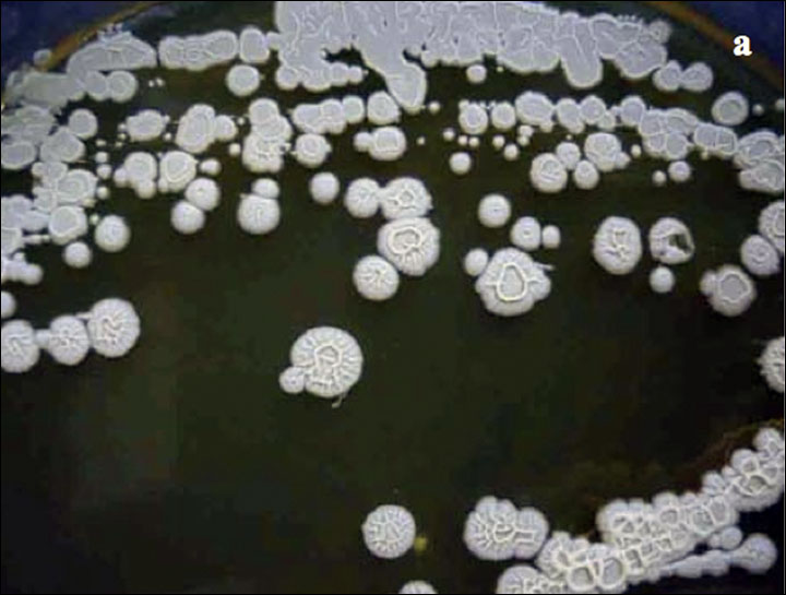 bacteria_black.jpg