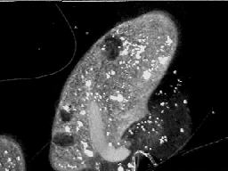 paramecium1150hz.jpg