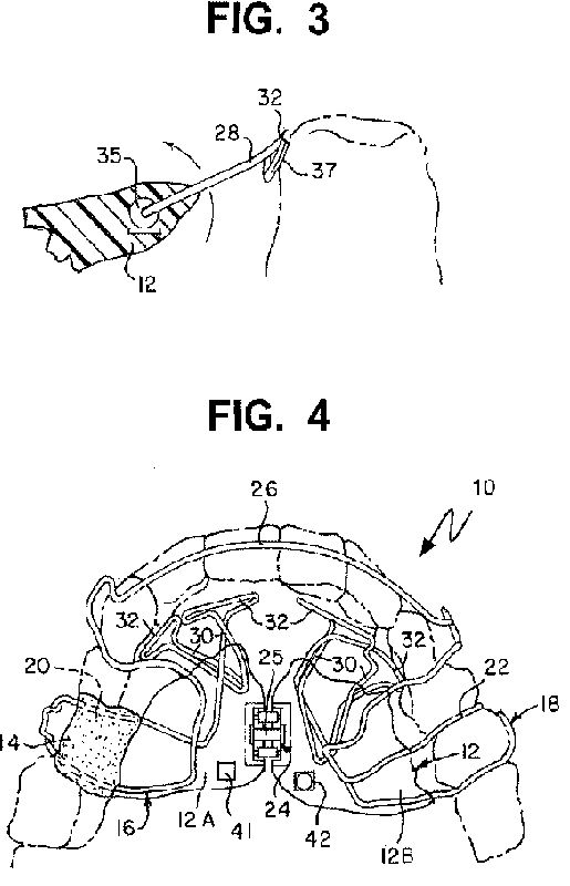 fig34.jpg