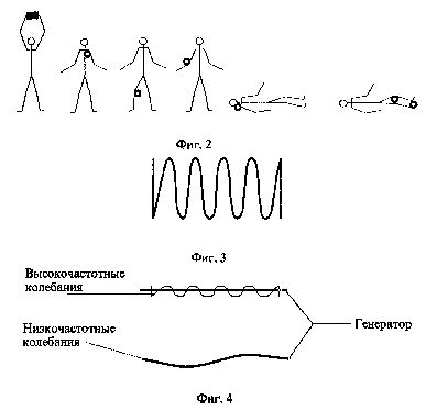 ru2143289a.jpg