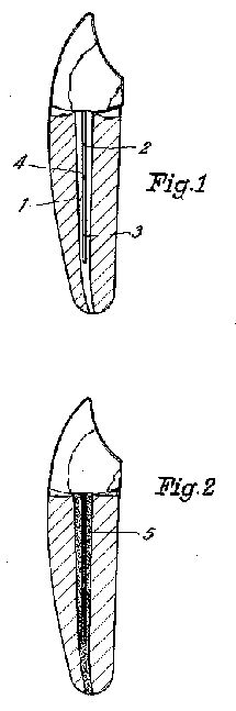 gb394a.jpg