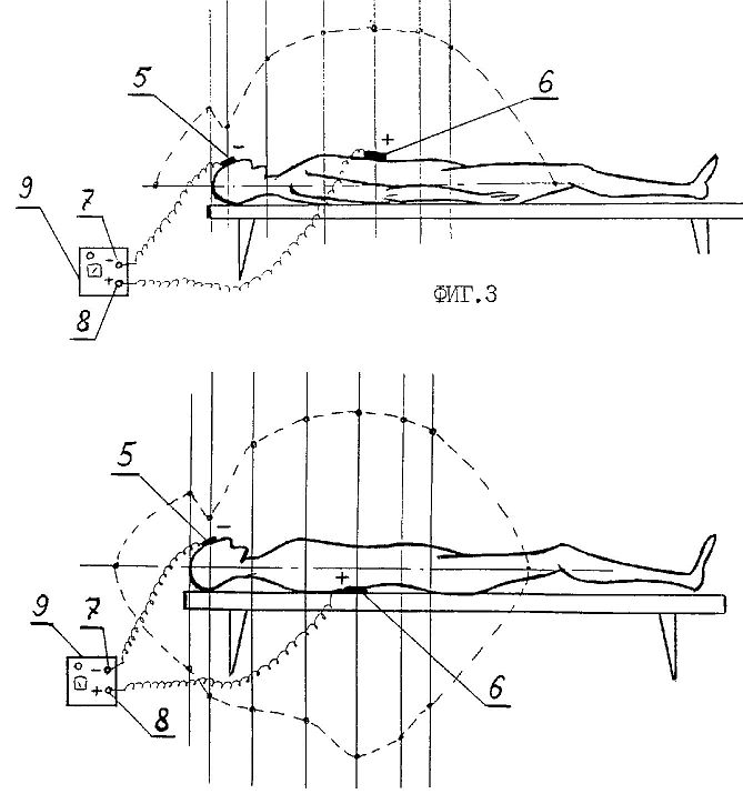 ru2089235b.jpg