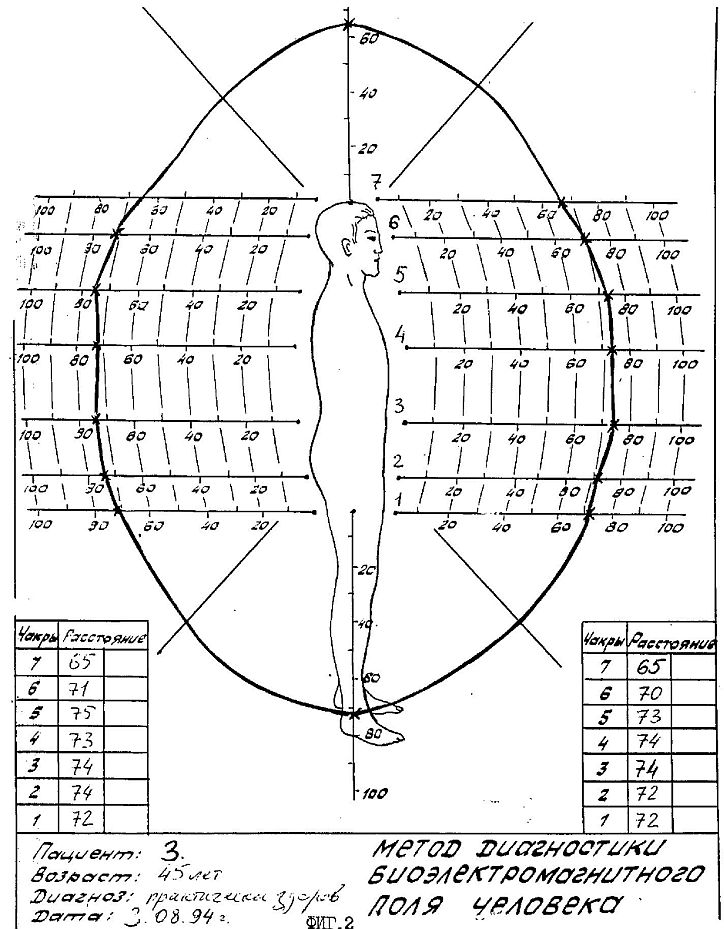 ru2118124a.jpg