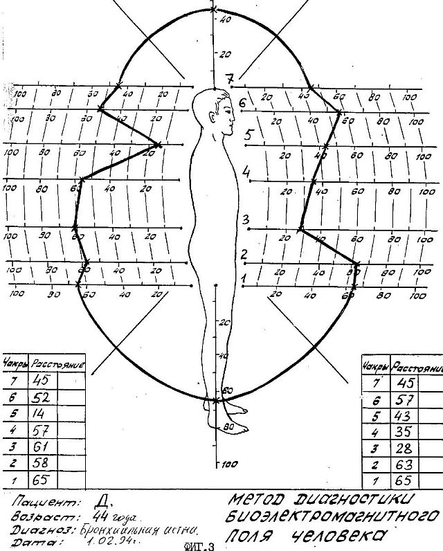 ru2118124b.jpg