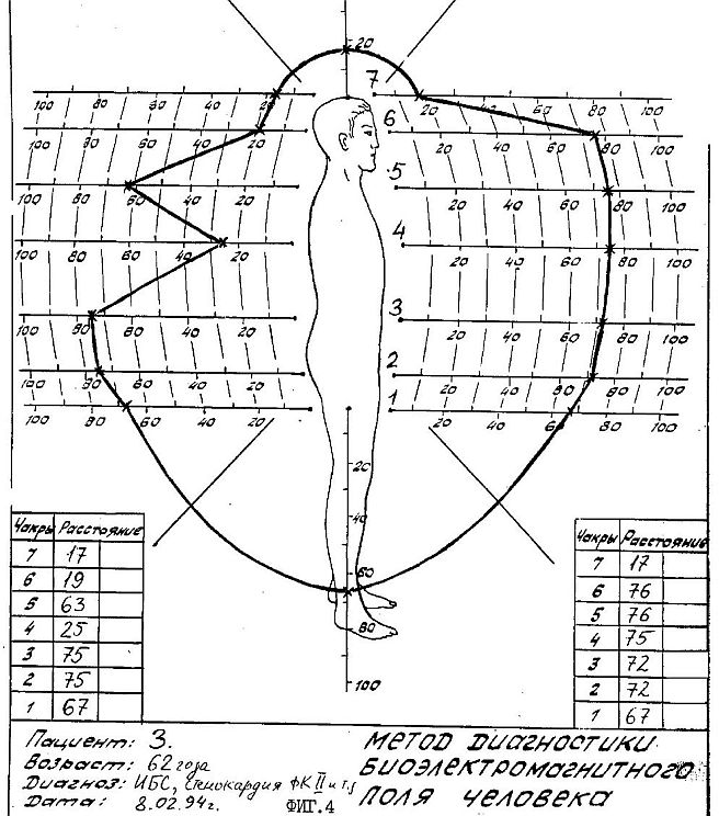 ru2118124c.jpg