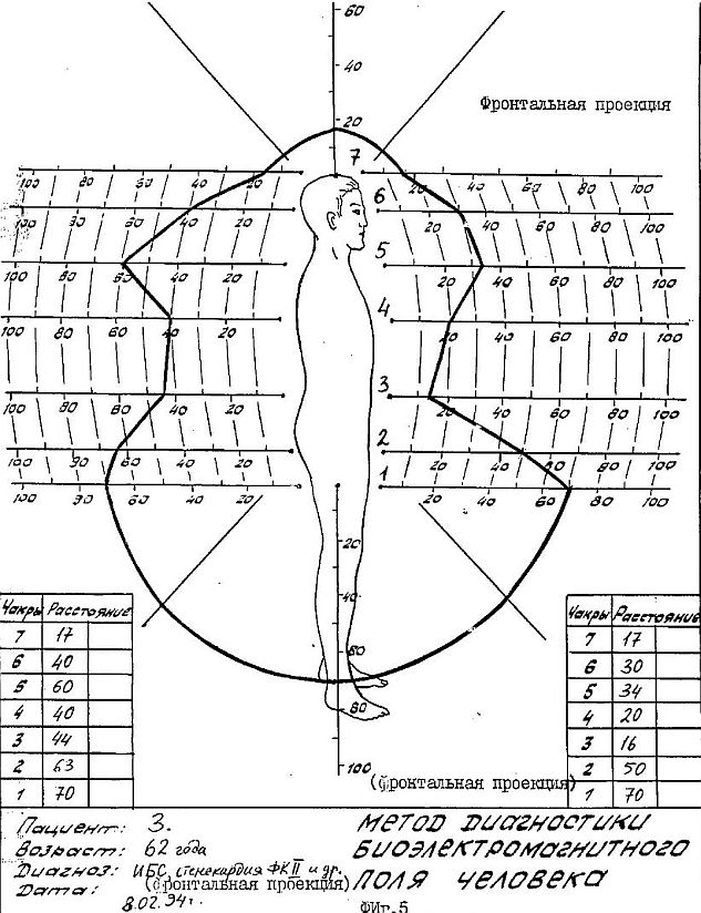 ru2118124d.jpg