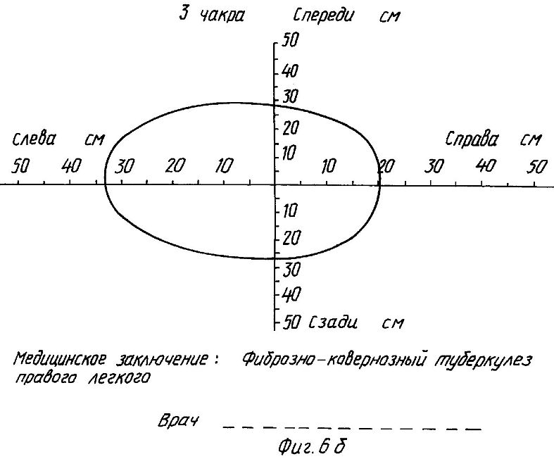 ru2118124f.jpg