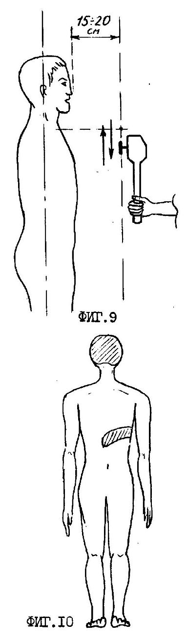 ru2118124i.jpg