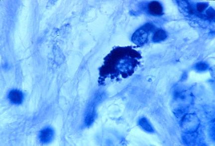 intecellularBreast.jpg