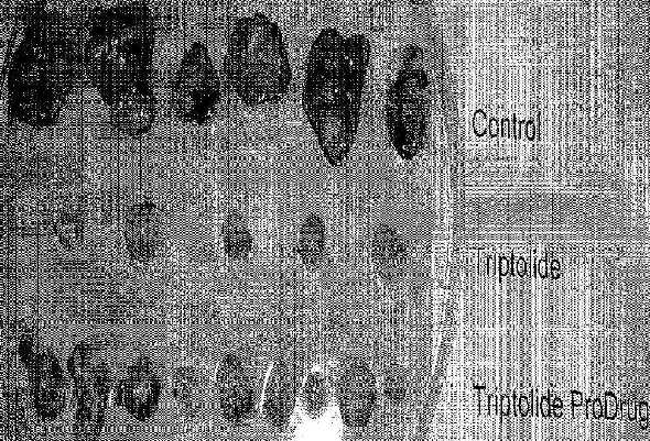 prodrugtumor2.jpg